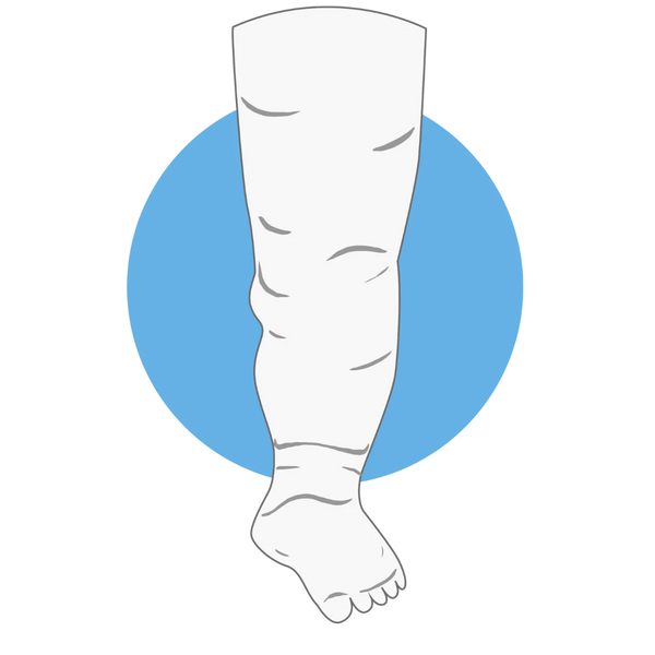 Lymphedema
